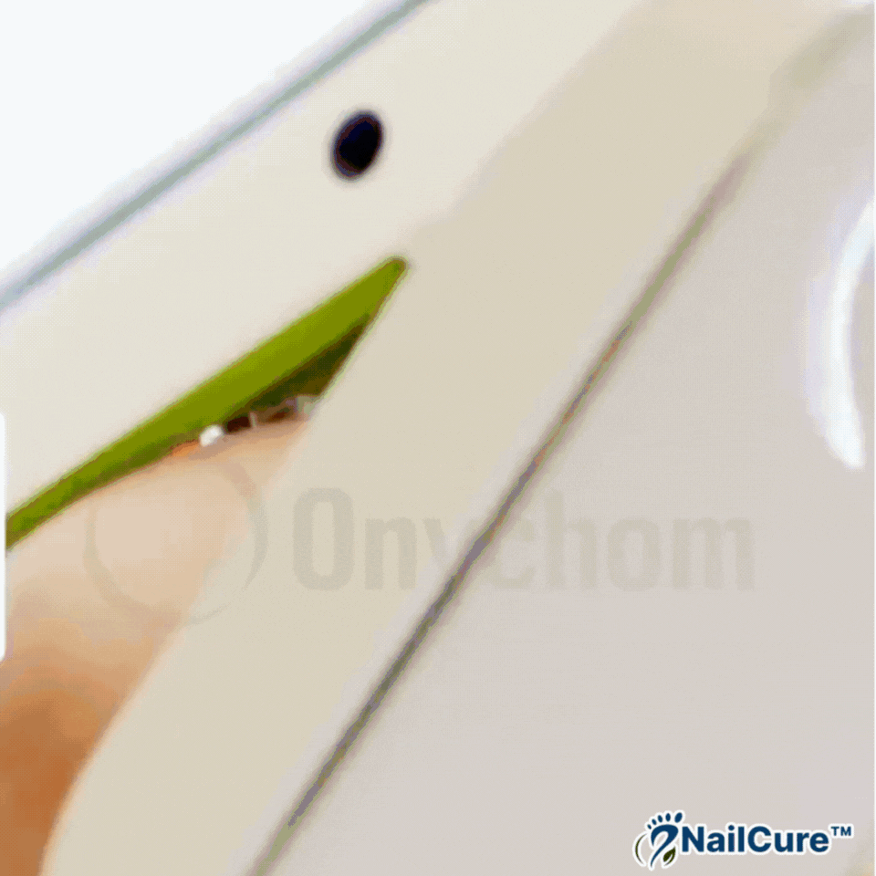 NailCure™ Behandelingsapparaat